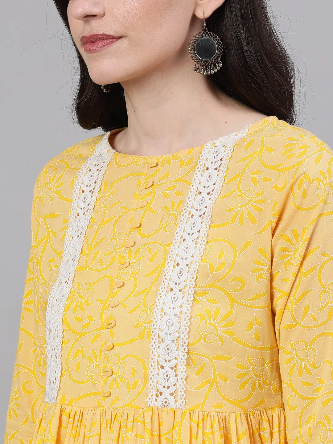 Women Yellow Front Yoke Lace Detail Printed Dress